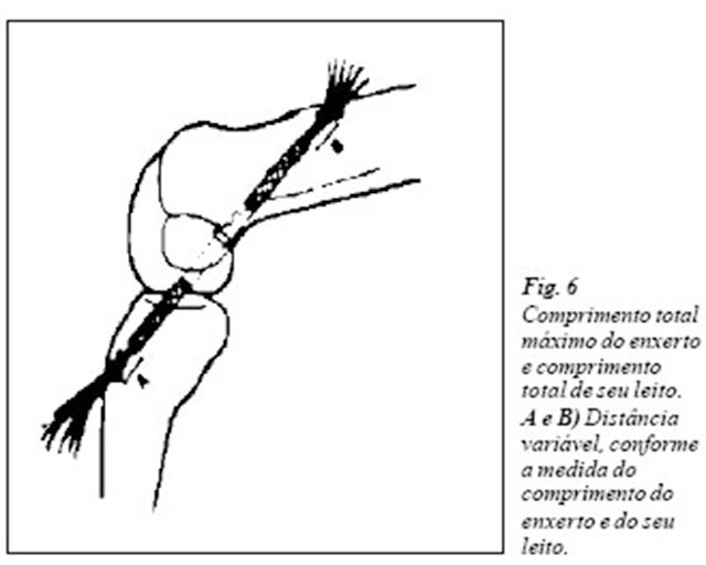 comprimento total maximo do enxerto (fig 06)