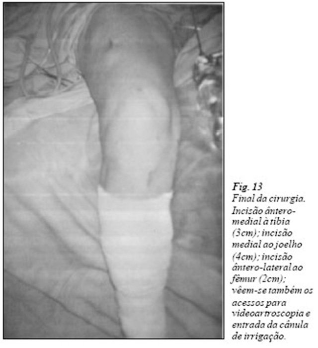 final da cirurgia (fig 13)