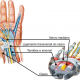 sindrome-do-tunel-do-carpo (1)