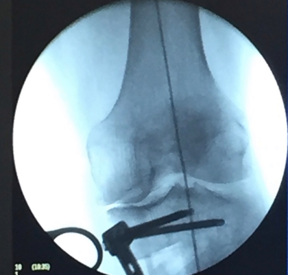 centro de reparo da cartilagem e ortopedia regenerativa (4)